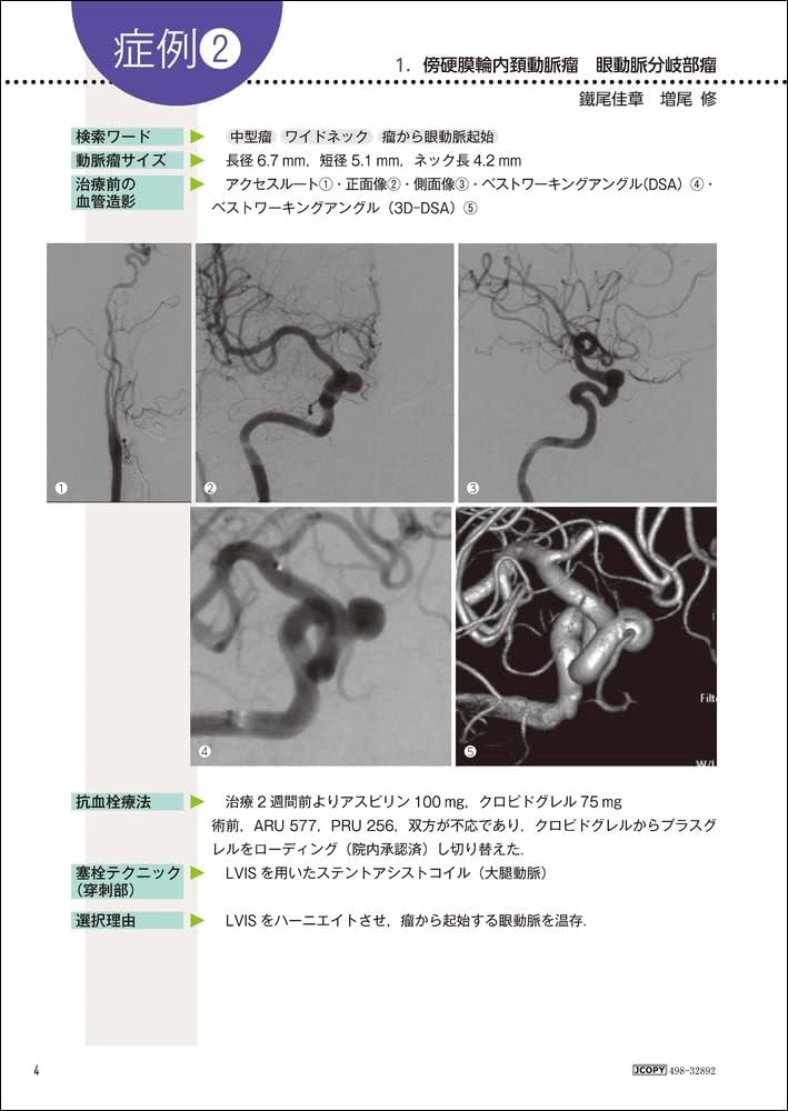 61XPeIYcxmL._AC_UF1000,