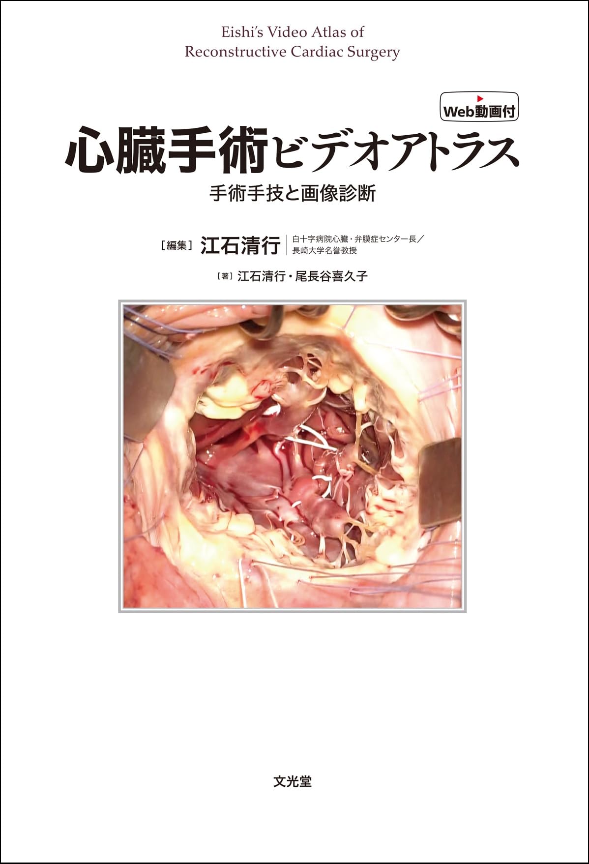 心臓手術ビデオアトラス 手術手技と画像診断［Web動画付］ | 江石清行