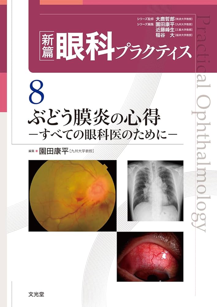 ぶどう膜炎の心得 (新篇眼科プラクティス 8) | 園田康平 |本 | 通販