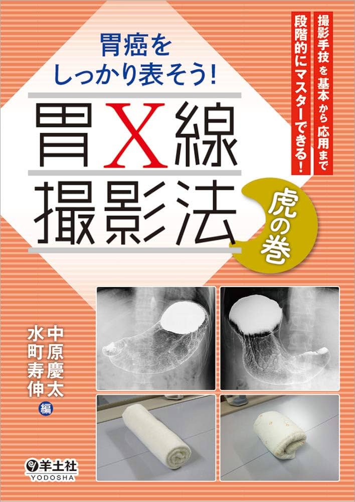 胃癌をしっかり表そう！ 胃X線撮影法 虎の巻〜撮影手技を基本から応用