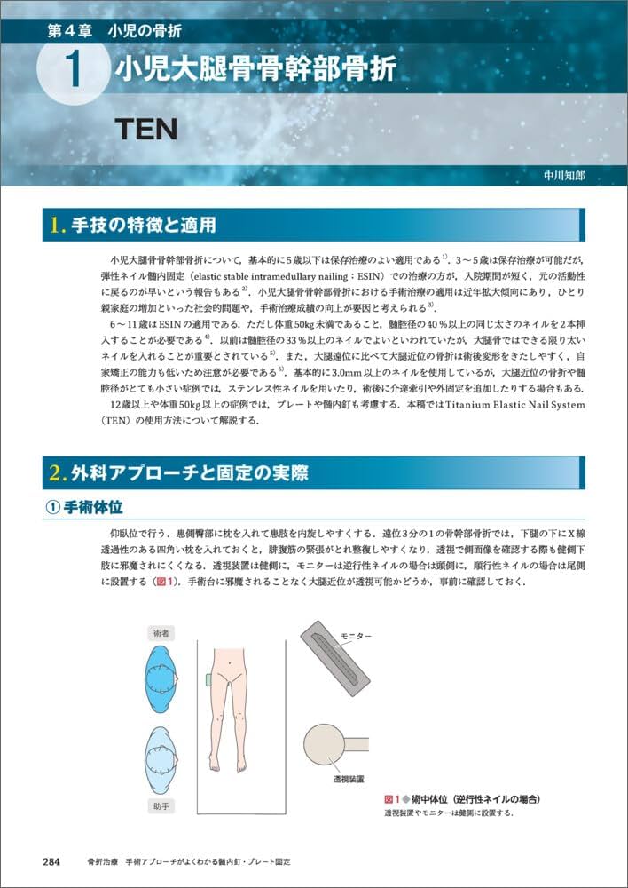 骨折治療 手術アプローチがよくわかる髄内釘・プレート固定 | 渡部 欣