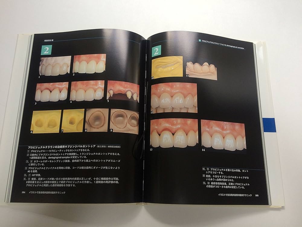 91v6fqgqzbL._AC_UF1000,