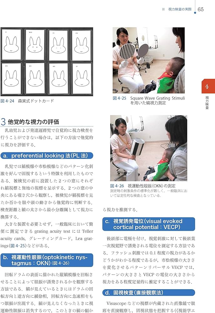 Amazon.co.jp: 視能検査学 (視能学エキスパート) : 公益社団法人 日本