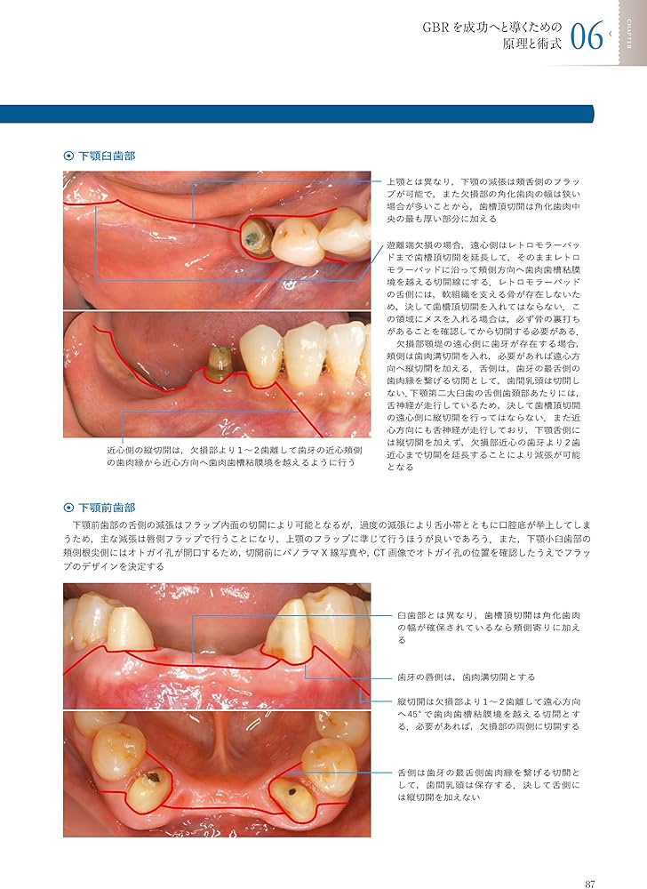 The Fabric of the Modern Implantology 近代インプラント治療の