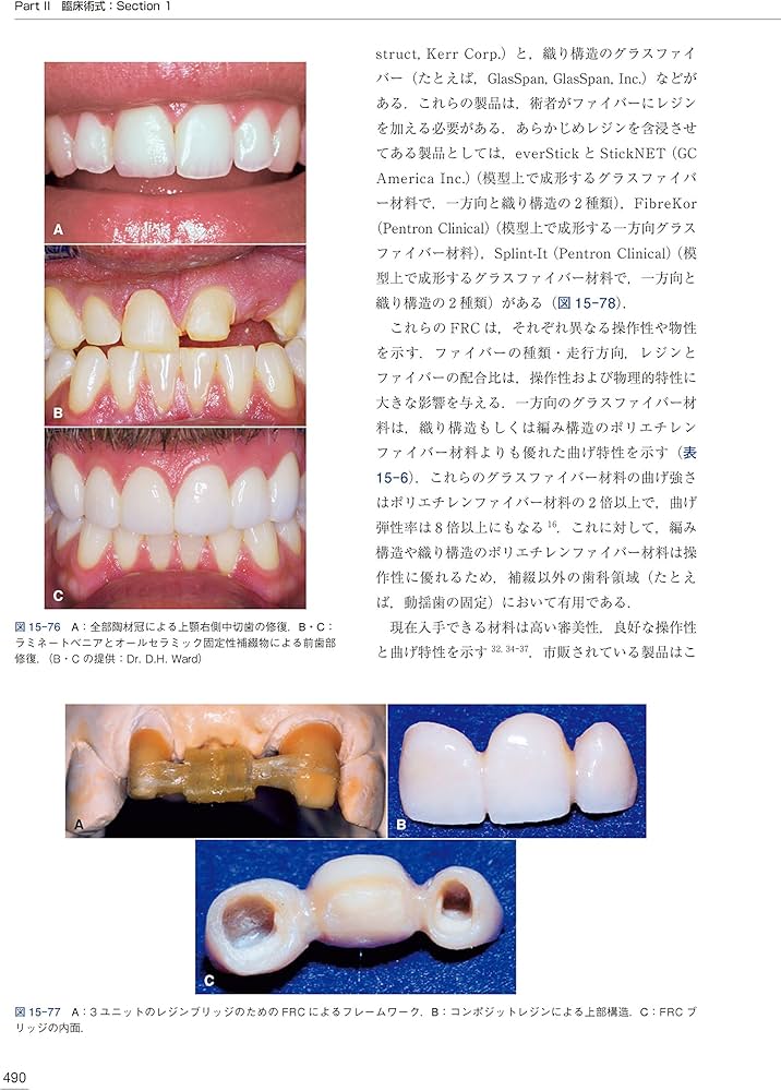 クラウンブリッジの臨床 原著第5版 | Stephen F.Rosenstiel, Martin f