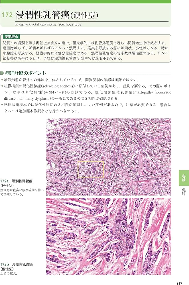 組織病理カラーアトラス[Web付録付] 第3版 | 坂本 穆彦 |本 | 通販