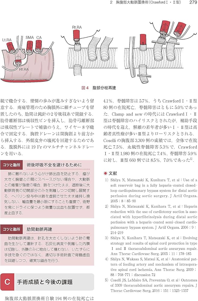 心臓・大動脈外科手術: 基本・コツ・勘所 | 小坂 眞一 |本 | 通販 | Amazon