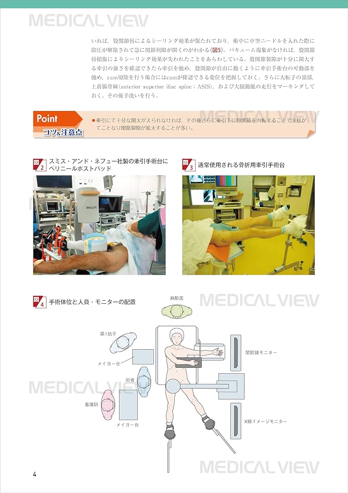 股・膝関節の鏡視下手術［Web動画付］ (新OS NEXUS No.10) | 松田 秀一