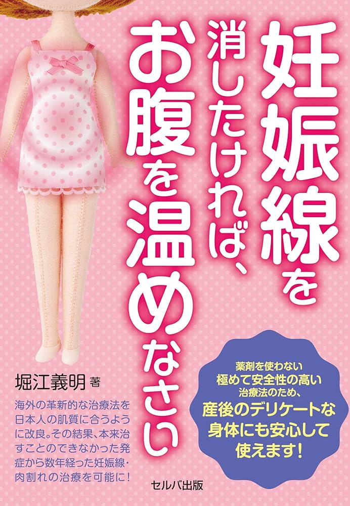妊娠線を消したければ、お腹を温めなさい | 堀江 義明 |本 | 通販 | Amazon