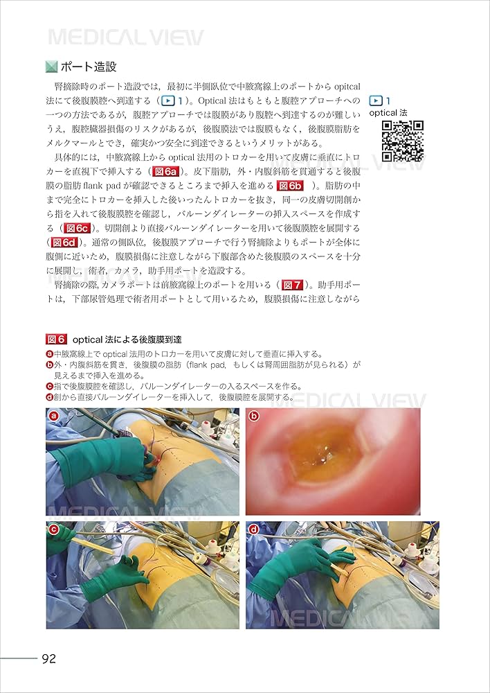 究める 腎・副腎腫瘍に対する腹腔鏡・ロボット支援手術［Web動画付