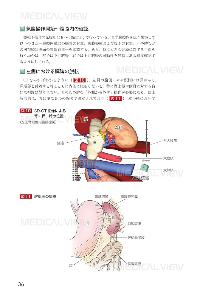 究める 腎・副腎腫瘍に対する腹腔鏡・ロボット支援手術［Web動画付