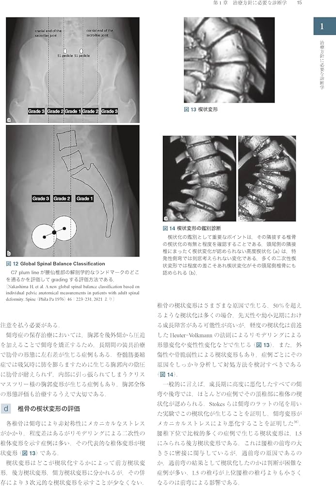 Amazon.co.jp: 症例から学ぶ小児脊柱変形（基礎から難治性疾患まで