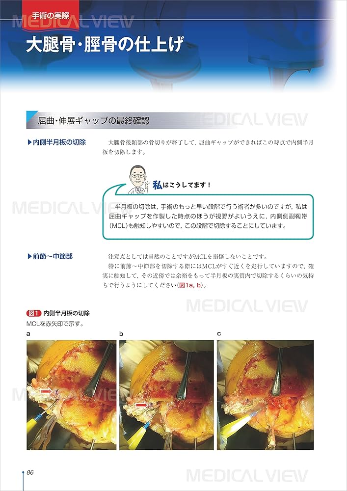 阪和人工関節センター TKAマニュアル−Basic Course | 格谷 義徳 |本