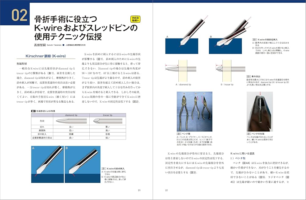 骨折のピンニングと経皮的スクリュー固定： 経皮テクニック完全攻略