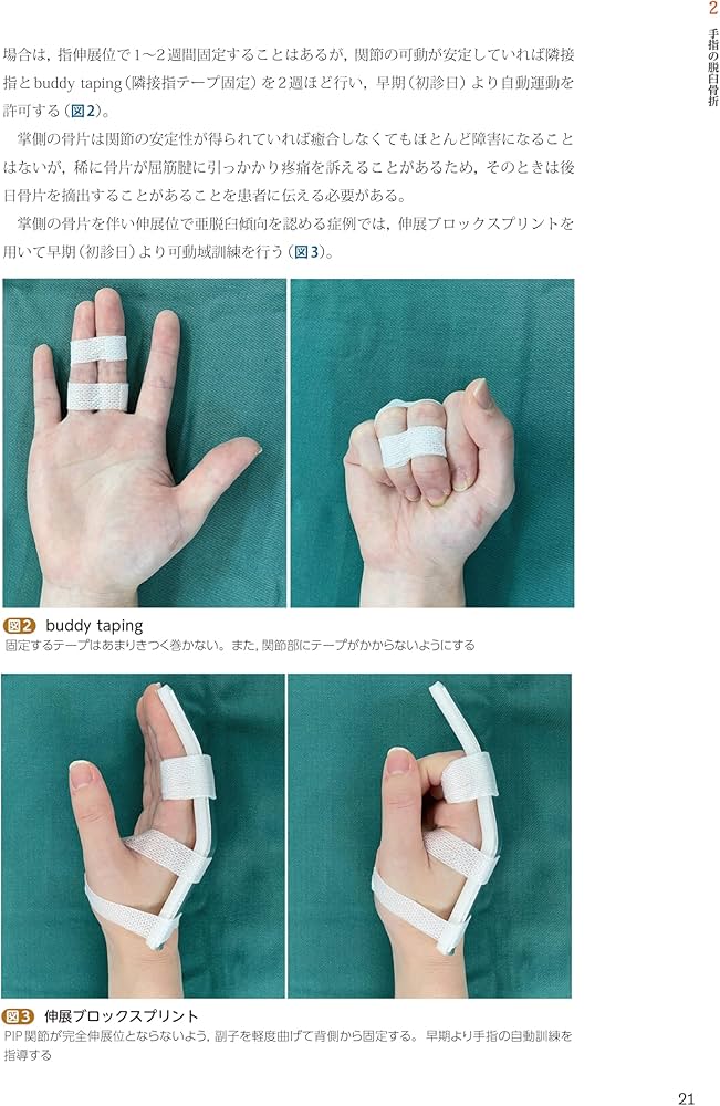 手外科手術ノート part2：代表的な骨折・外傷編 | 大井宏之 |本 | 通販