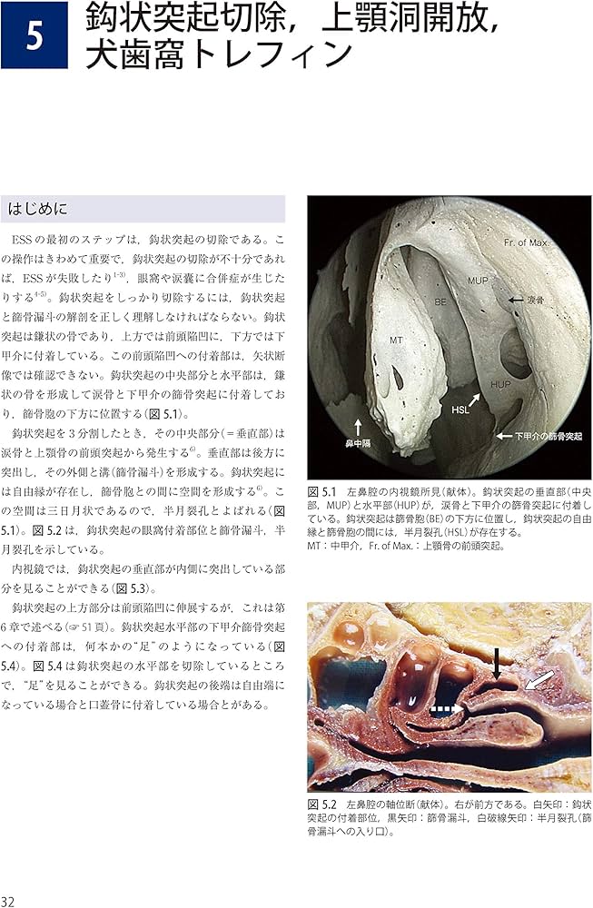 Amazon.co.jp: ウォーモルド内視鏡下鼻副鼻腔・頭蓋底手術 : 本間 明宏: 本