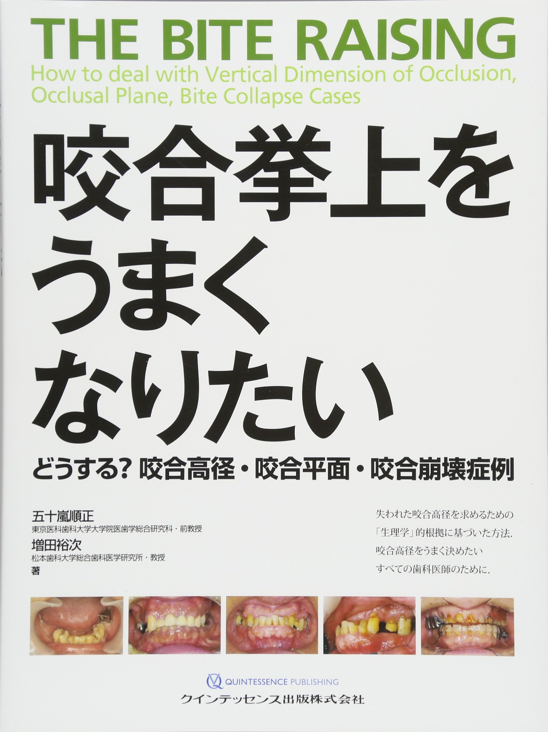 咬合挙上をうまくなりたい | 五十嵐 順正, 増田 裕次 |本 | 通販 | Amazon