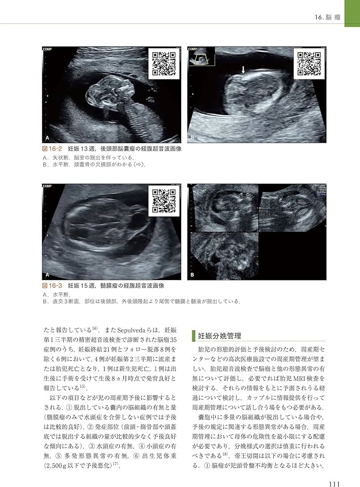 周産期マニュアル: 胎児疾患の診断から管理まで | 佐村 修, 宗田 聡