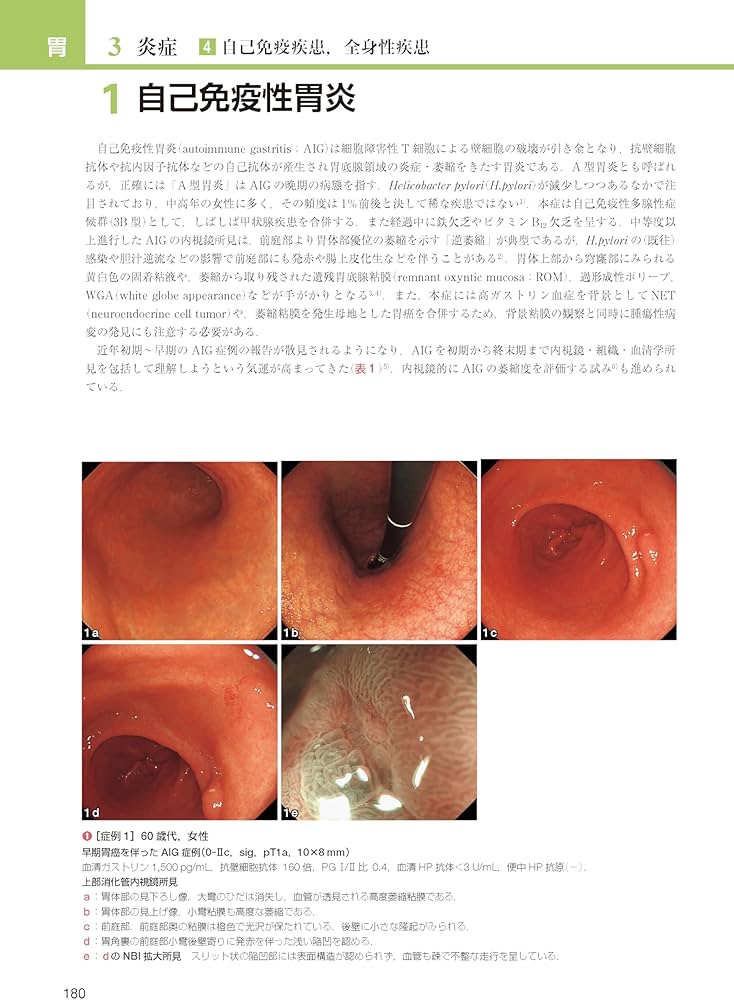胃と腸アトラスI 上部消化管 第3版 | 「胃と腸」編集委員会, 蔵原 晃一