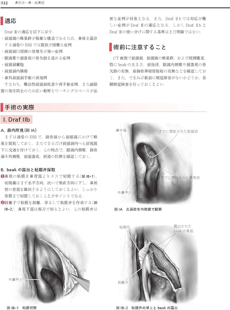 耳鼻咽喉・頭頸部手術アトラス[上巻] 第2版 | 森山 寛 |本 | 通販 | Amazon