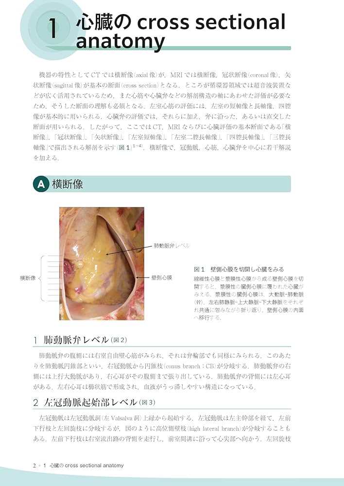 心臓疾患のCTとMRI 第2版 | 佐久間肇, 陣崎雅弘, 北川覚也, 石田正樹