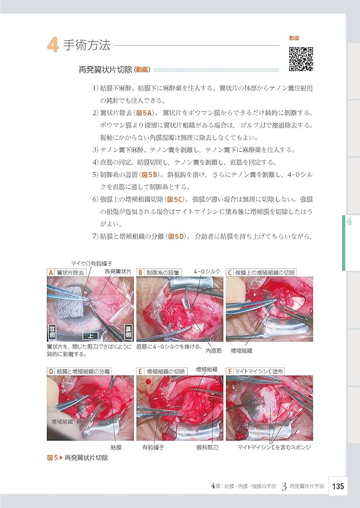 眼科レジデントのためのベーシック手術 ─ 電子版付 ─ | 谷戸正樹 |本
