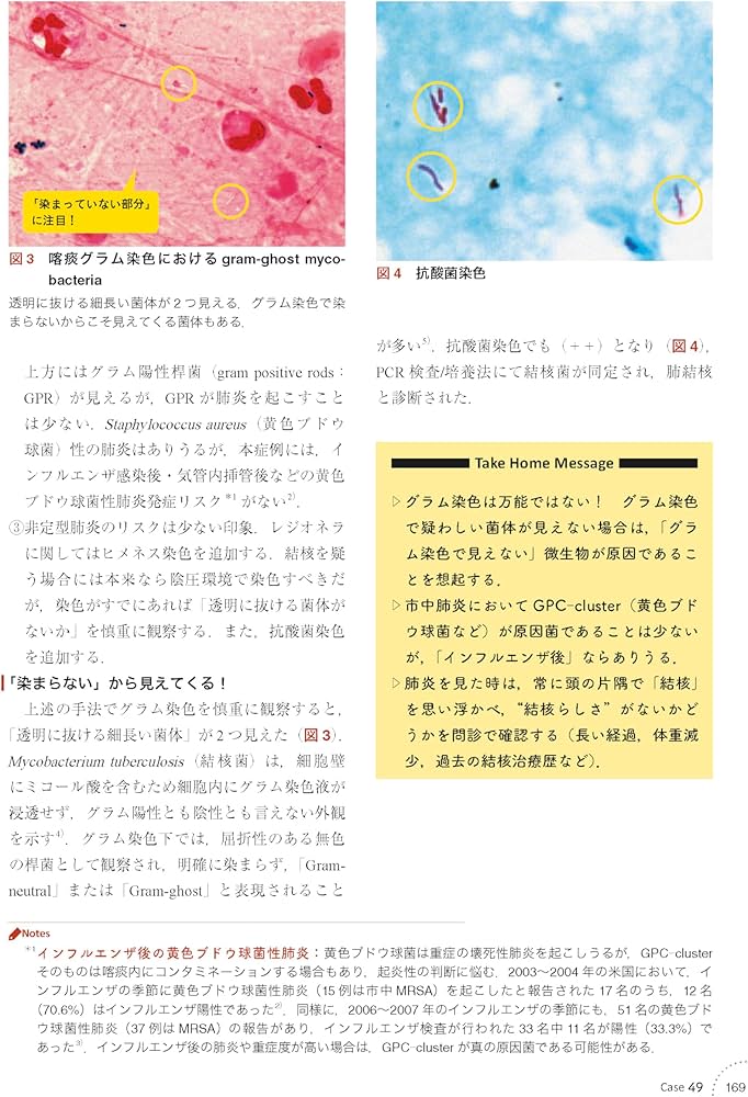 感染症内科ドリル WEB版付: みるトレ決定版 | 笠原 敬, 忽那 賢志