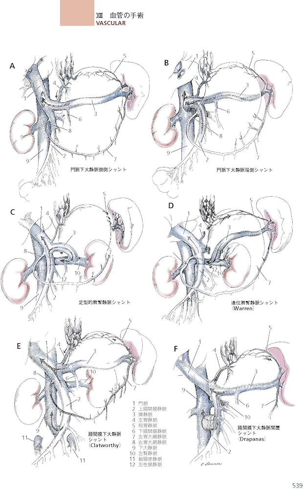 Amazon.co.jp: ゾリンジャー外科手術アトラス 第2版 : 安達 洋祐