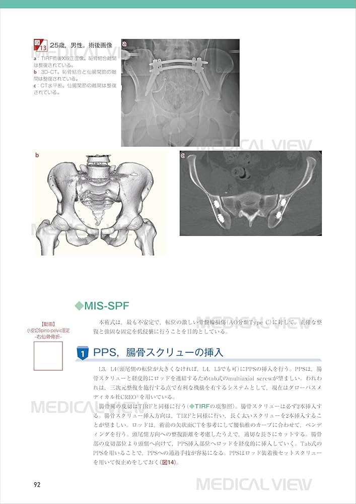 最小侵襲脊椎外科［Web動画付］ (新OS NEXUS No.11) | 佐藤 公治 |本