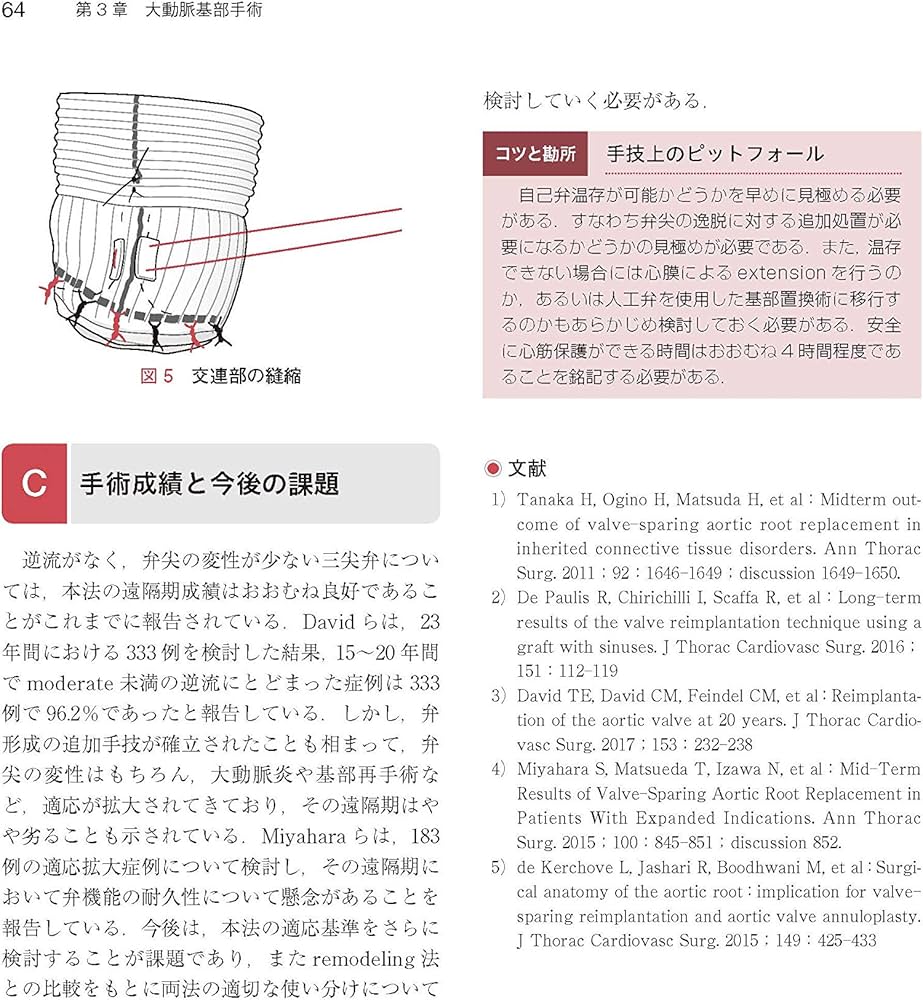 心臓・大動脈外科手術 基本・コツ・勘所 心臓・大動脈外科手術: 基本