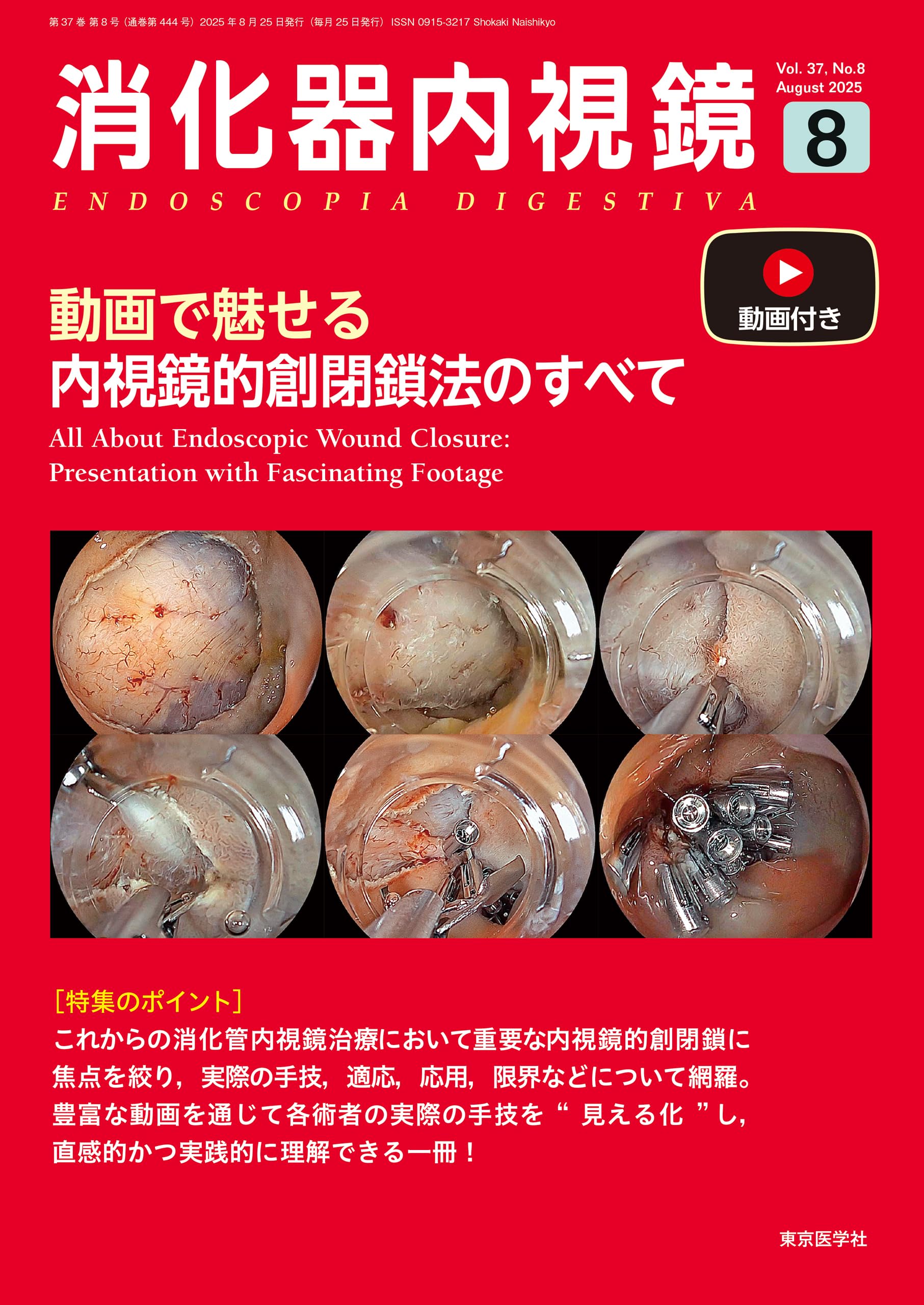 消化器内視鏡37巻8号2025年8月号 動画で魅せる内視鏡的創閉鎖法の