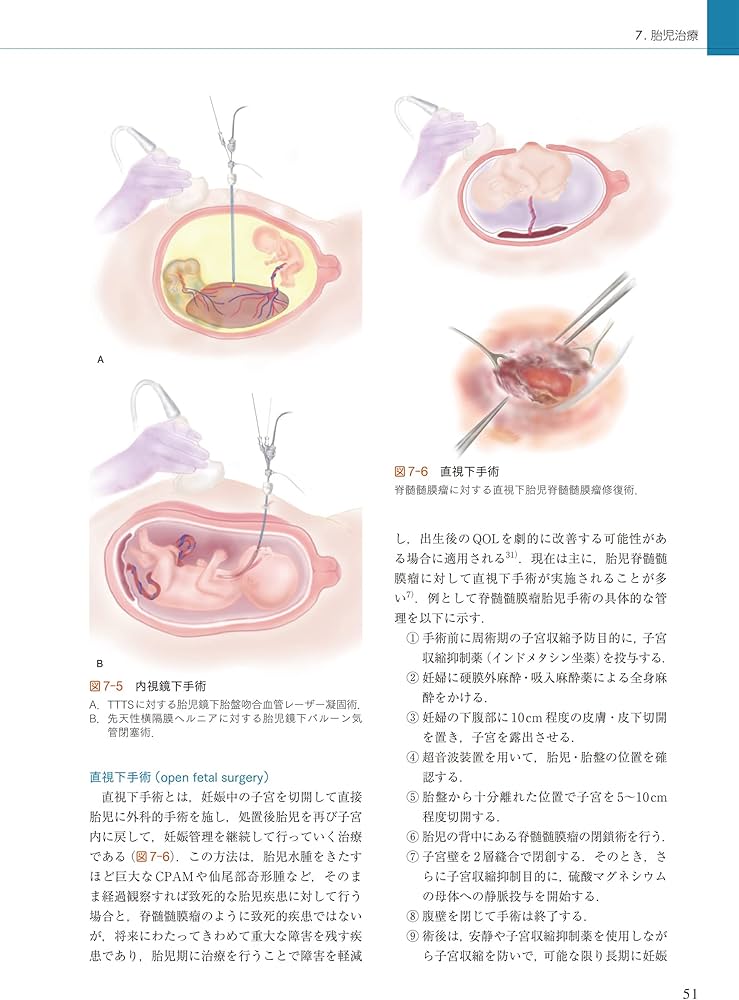 周産期マニュアル: 胎児疾患の診断から管理まで | 佐村 修, 宗田 聡