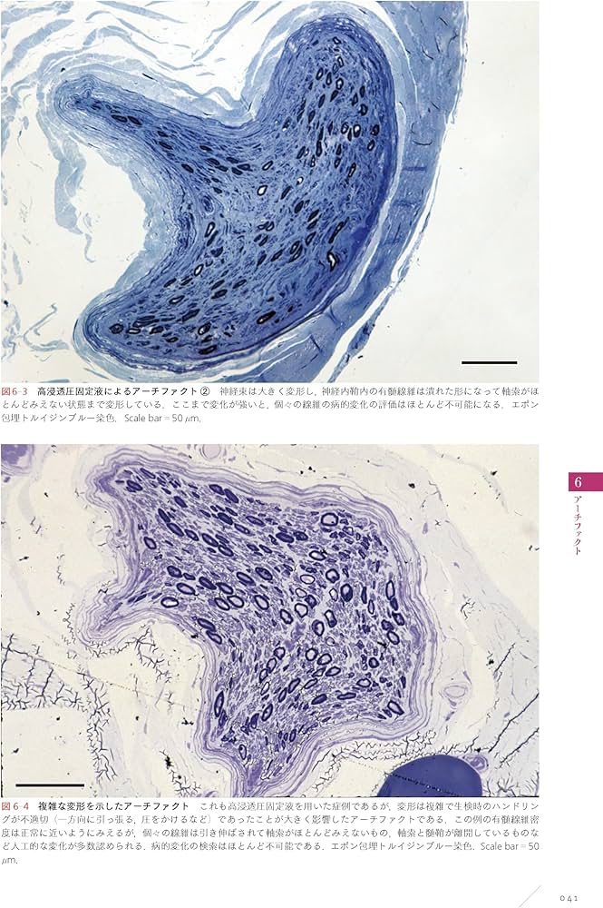末梢神経病理：どう作り、どう読み、どう臨床に生かすか | 神田隆