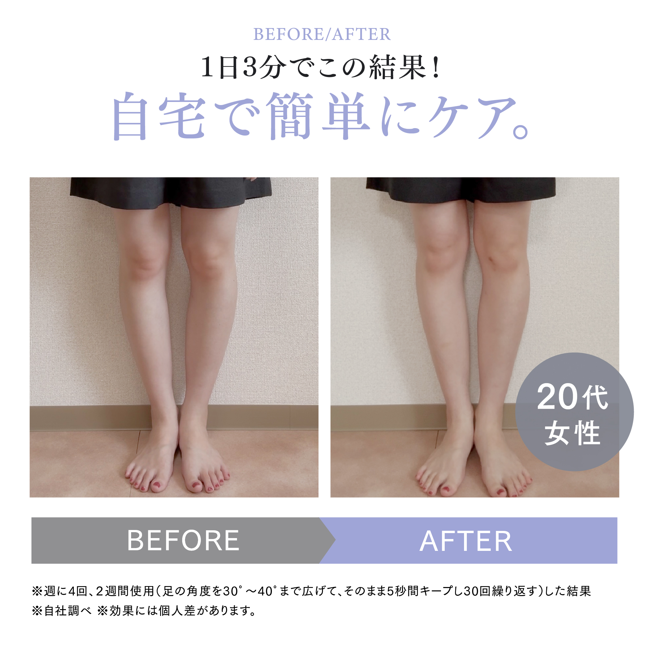 MYTREX MODIFIT LEG | O脚矯正サポート まっすぐ美脚への新習慣。