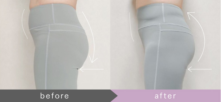 MYTREX AQUA LIFT | EMS ヒップトレーニングマシーン | お風呂で作る