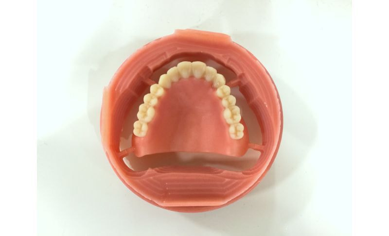 大前式総入れ歯治療システム│総入れ歯専門のパリムデンタル