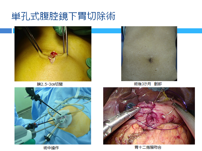 上部消化管 | JCHO大阪病院（旧大阪厚生年金病院） | 地域医療機能推進