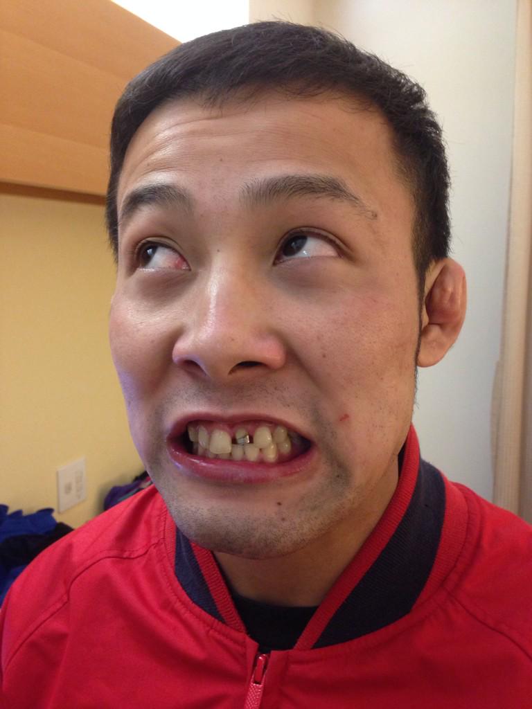 歯抜けおじさん。高藤直寿。