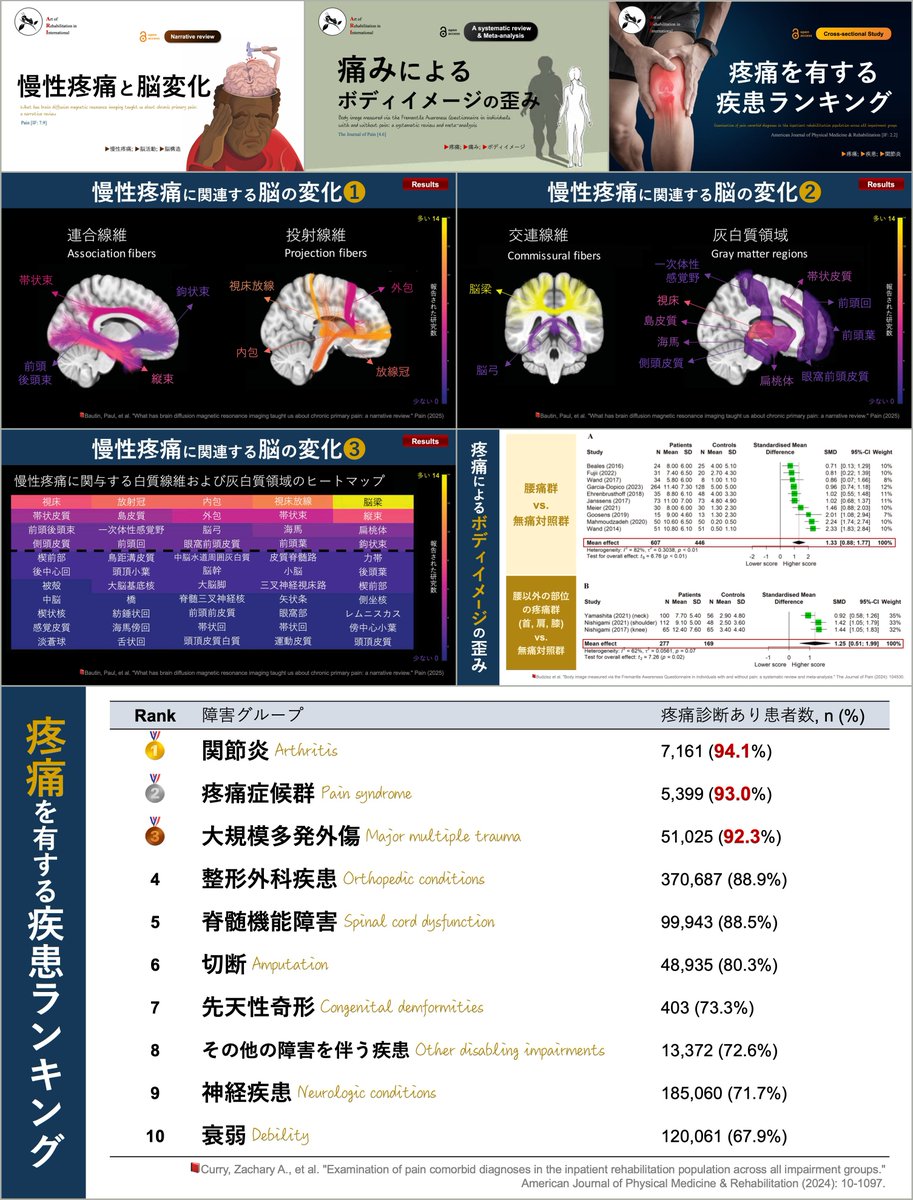 人生で経験する最大の痛み💡 群発頭痛は出産より痛い❗️ 疼痛関連の