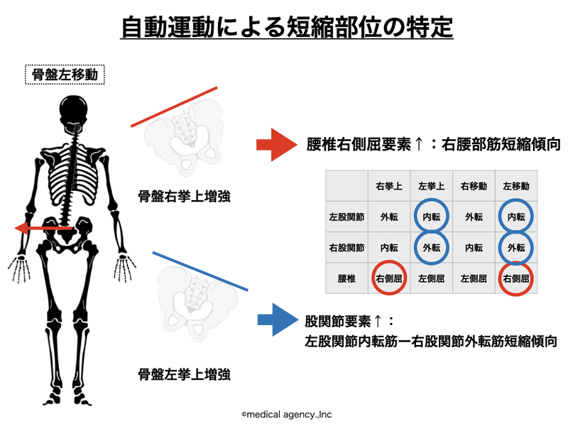 姿勢・運動の観察～身体重心の見方とその評価方法～ | 理学療法士