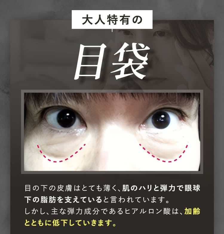 platinum hifu プラチナハイフ | spine