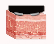 4D STYLE STINGER｜業務用エステ機器・化粧品の総合美容メーカー 株式