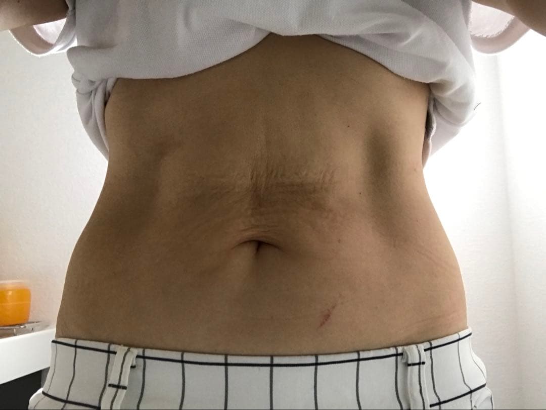 35→32万　楽トレ　エクスケア・ディーアイ　筋肉刺激器　　お腹の筋肉割れます！