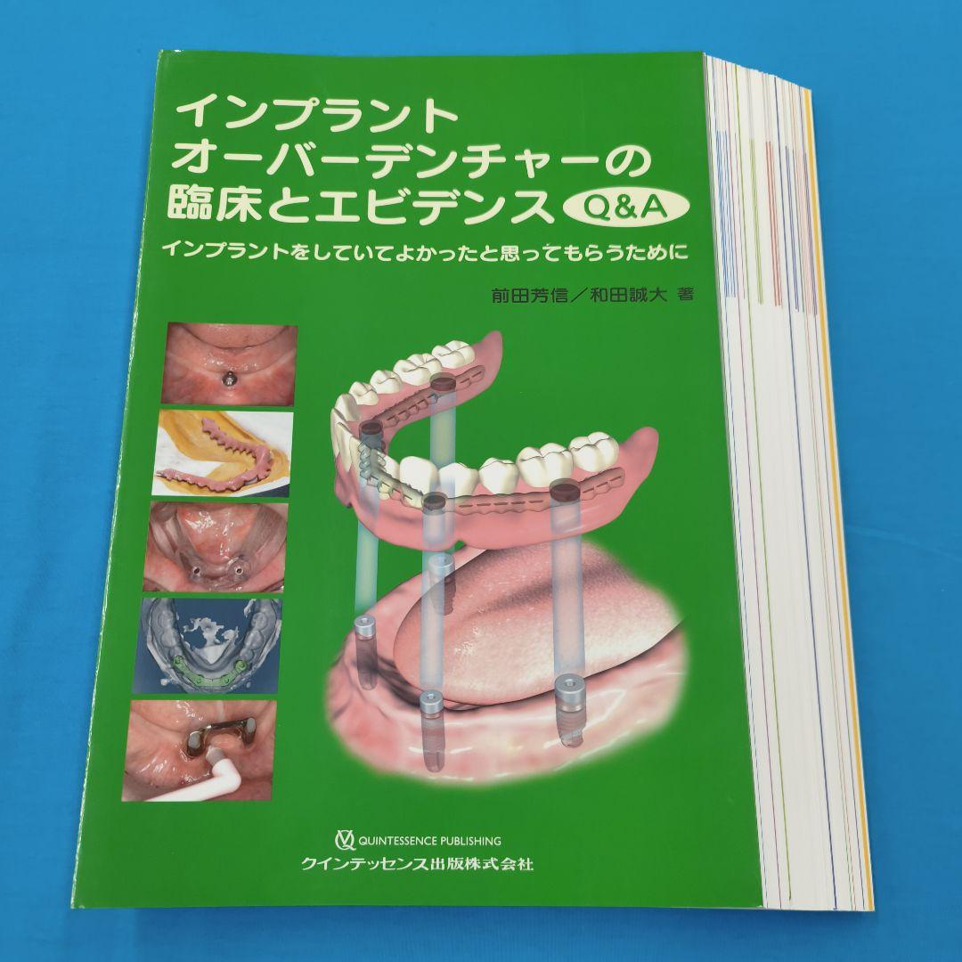 ☆裁断済 インプラントオーバーデンチャーの臨床とエビデンス Q&A インプラントオーバーデンチャーの臨床とエビデンスQ＆A