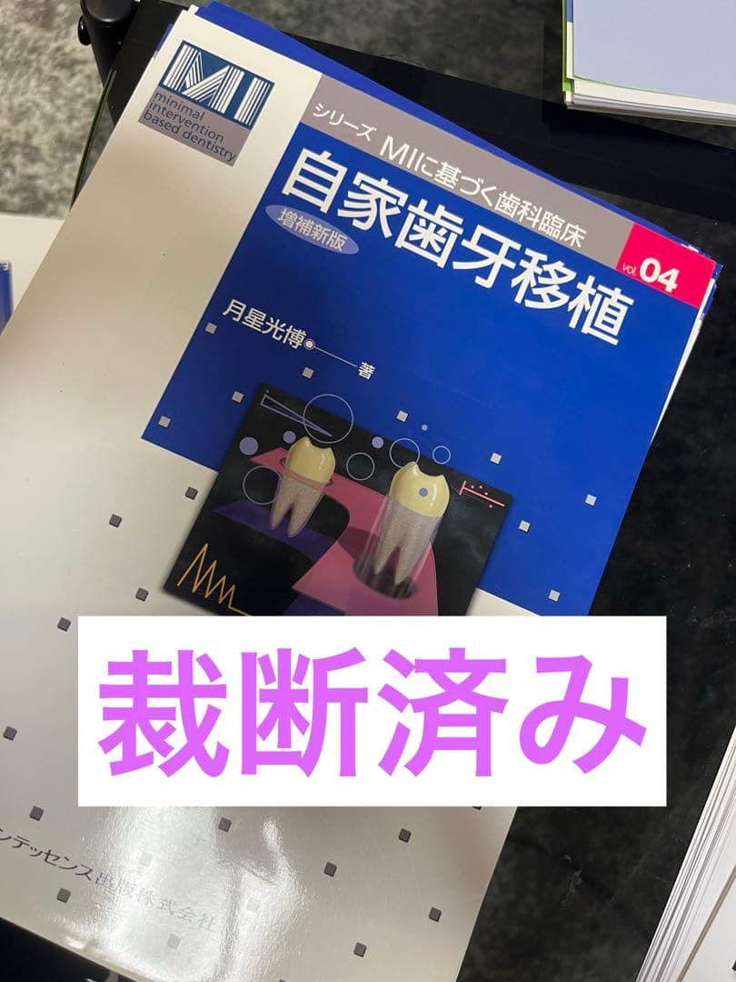 自家歯牙移植 MIに基づく歯科臨床 04 自家歯牙移植 増補新版 (シリーズ MIに基づく歯科臨床) | 月星 光博