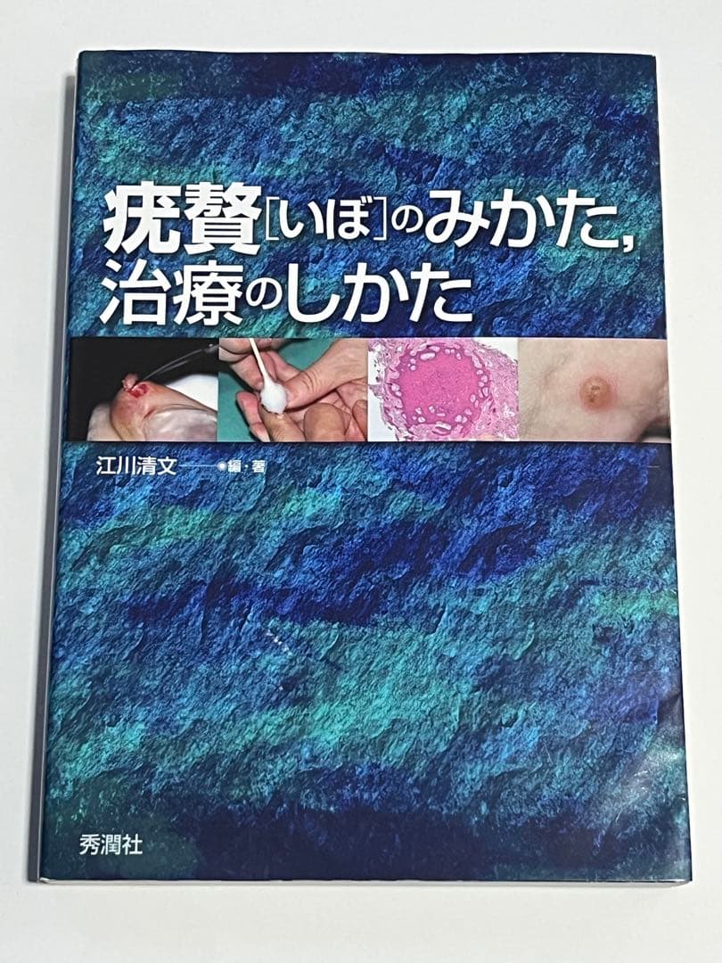 疣贅(いぼ)のみかた、治療のしかた 疣贅（いぼ）のみかた、治療のしかた / 江川 清文【編著】 - 紀伊國屋