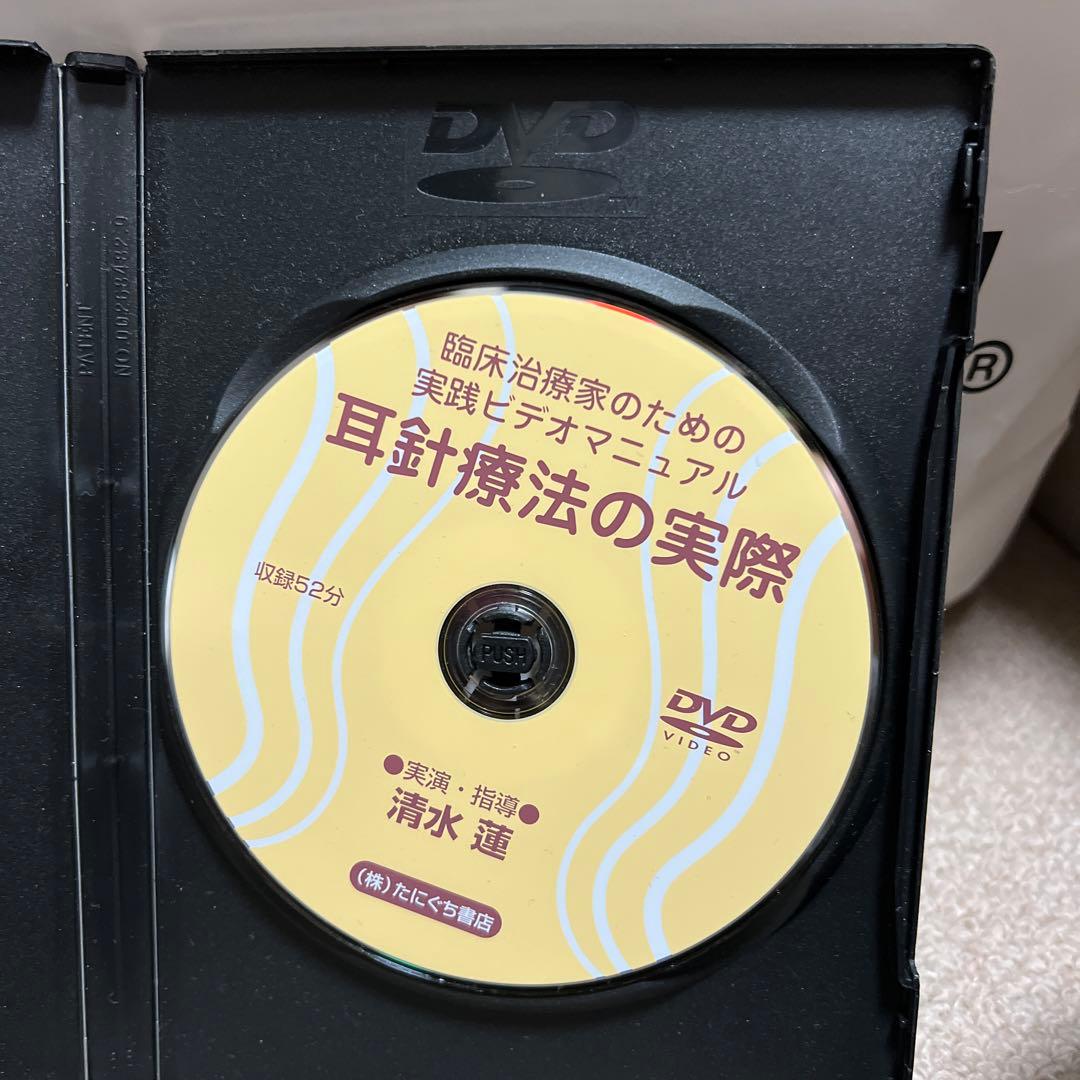耳針療法の実際　DVD