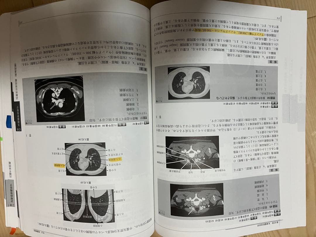 2025 診療放射線技師 国家試験 完全対策問題集 - メルカリ
