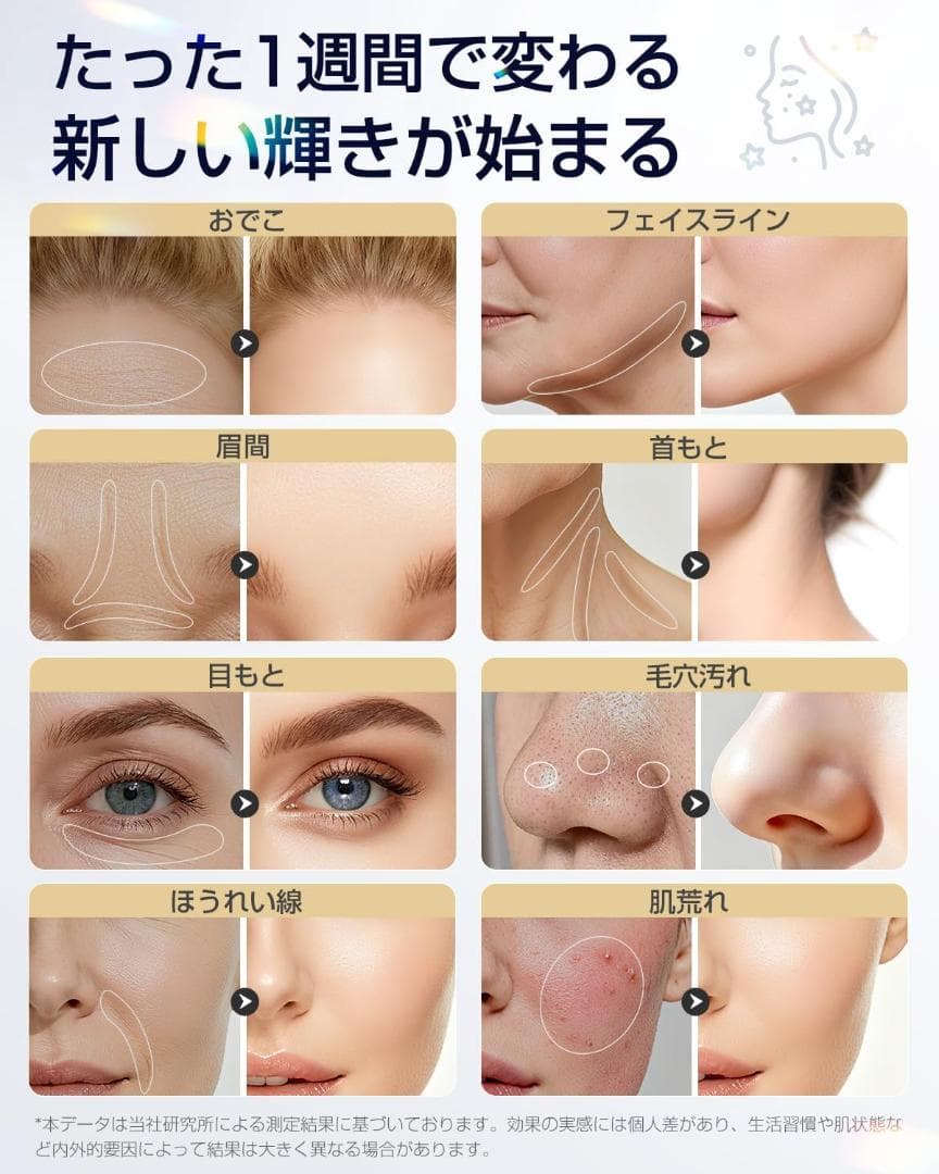 美顔器 高周波 EMS 18役 光エステ リフトケア 毛穴洗浄 オールインワン