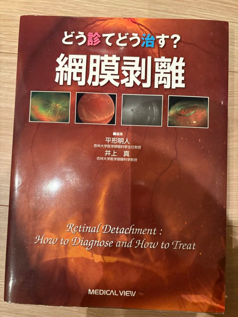 どう診てどう治す？網膜剥離 どう診て どう治す? 網膜剥離 | 平形 明人, 井上 真 |本 | 通販 | Amazon